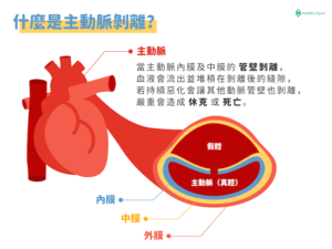 主動脈剝離會好嗎?主動脈剝離的常見症狀與預防 - Health2Sync Blog
